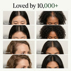 SLO | Korean Scalp Revival Bar