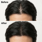 SLO | Korean Scalp Revival Bar